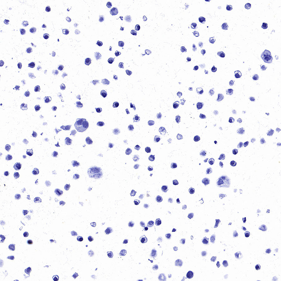 STEAP1 Recombinant Rabbit mAb (S-3613-107)
