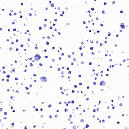 STEAP1 Recombinant Rabbit mAb (S-3613-107)
