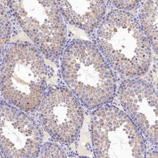 VPS35 Recombinant Rabbit mAb (S-997-2)