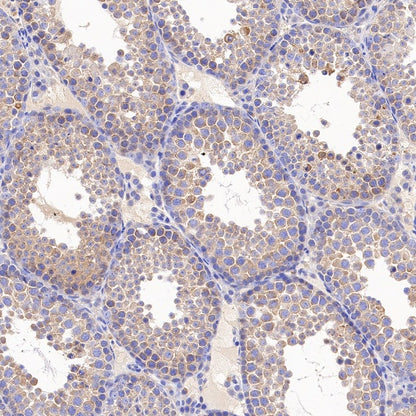 VPS35 Recombinant Rabbit mAb (S-997-2)