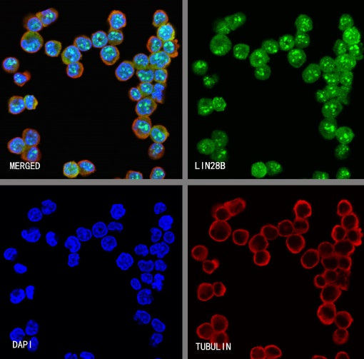 LIN28B Recombinant Rabbit mAb (S-2360-117)