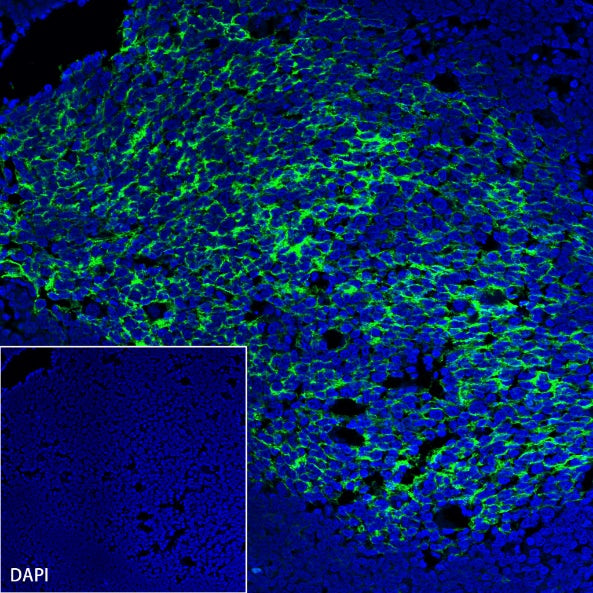 S-RMab® CD23 Recombinant Rabbit mAb (SDT-028-67)