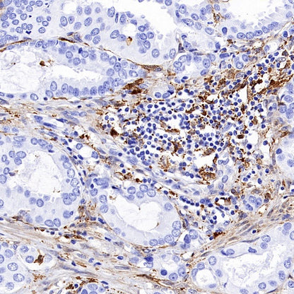FAP Recombinant Rabbit mAb (S-3094-29)