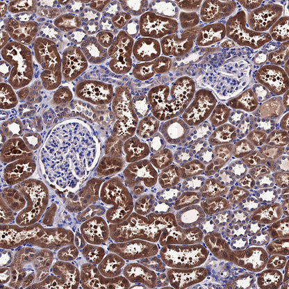 AMPKα Recombinant Rabbit mAb (S-455-38)