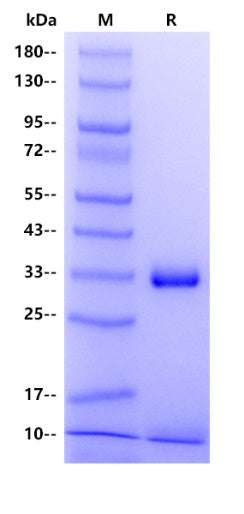 FcGRT&B2M Heterodimer His Tag Protein, Human
