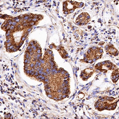 PBR/TSPO Recombinant Rabbit mAb (S-607-19)