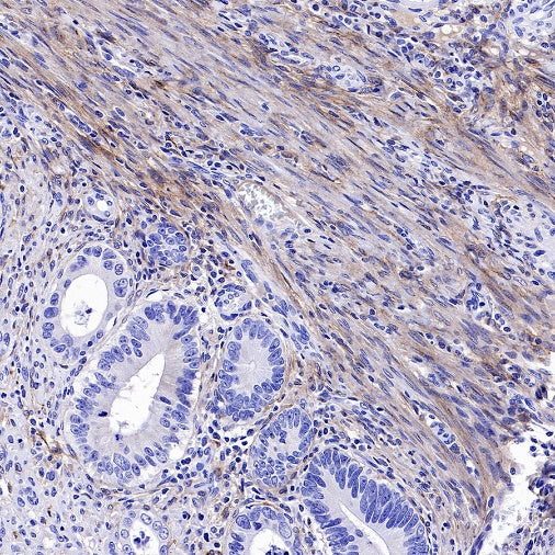 PDGFR alpha Recombinant Rabbit mAb (SDT-3353)