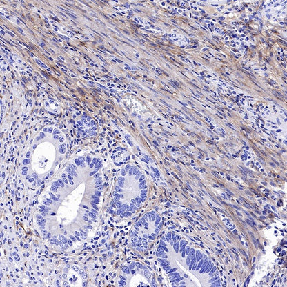 PDGFR alpha Recombinant Rabbit mAb (SDT-3353)