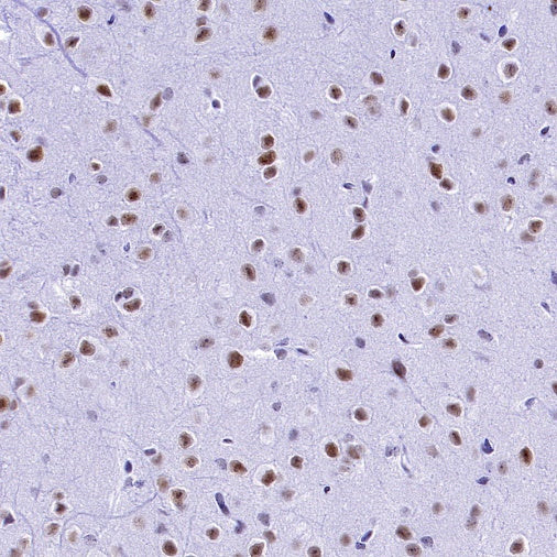 CDK9 Recombinant Rabbit mAb (S-2661-10)
