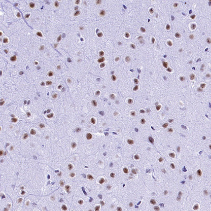 CDK9 Recombinant Rabbit mAb (S-2661-10)