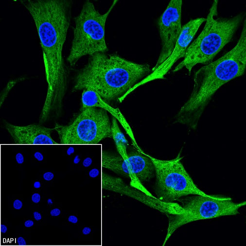Beta I tubulin Recombinant Rabbit mAb (S-3108-63)