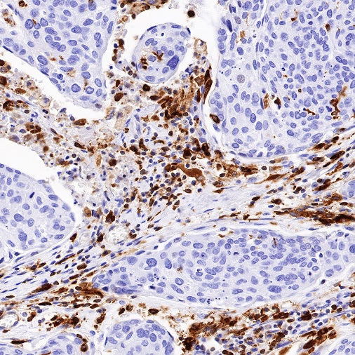 HLA-DPB1 Recombinant Rabbit mAb (S-R263)