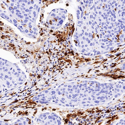 HLA-DPB1 Recombinant Rabbit mAb (S-R263)
