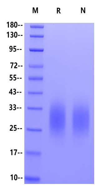 CD7 Ligand/SECTM1 His Tag Protein, Mouse