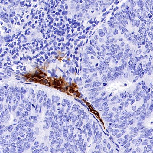 Hemoglobin alpha Recombinant Rabbit mAb (S-R242)