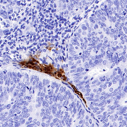 Hemoglobin alpha Recombinant Rabbit mAb (S-R242)