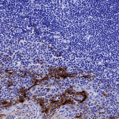 Mesothelin Recombinant Rabbit mAb (SDT-347-15)