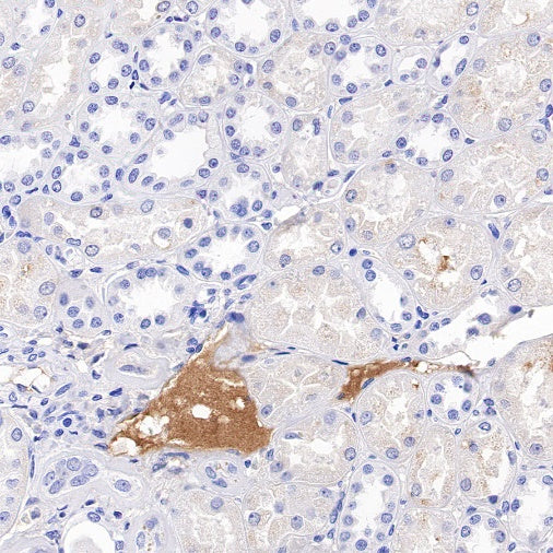 Transferrin Recombinant Rabbit mAb (S-1611-43)