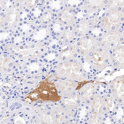 Transferrin Recombinant Rabbit mAb (S-1611-43)