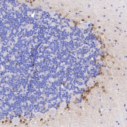 FABP7 Recombinant Rabbit mAb (S-762-114)