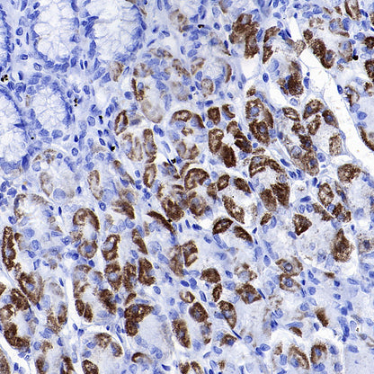 ATF-6 Recombinant Rabbit mAb (S-4366)