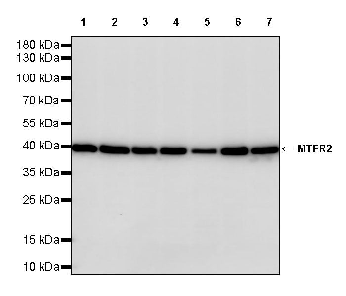 MTFR2 Recombinant Rabbit mAb (S-3842-54)