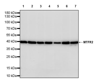 MTFR2 Recombinant Rabbit mAb (S-3842-54)