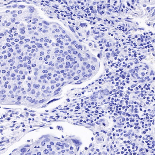 α/β-Synuclein Recombinant Rabbit mAb (S-309-72)