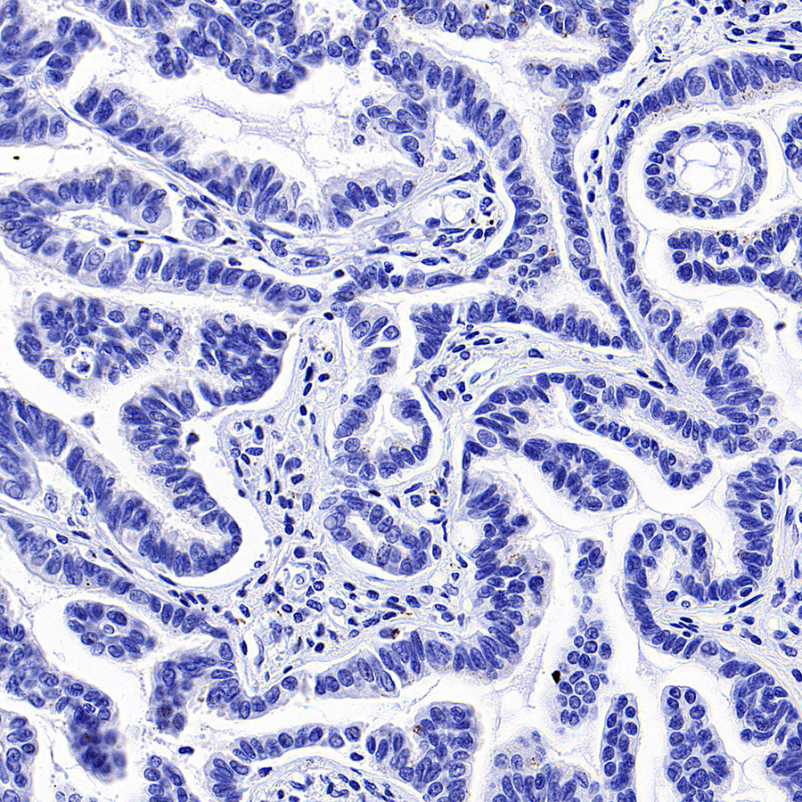 GRIA2 Recombinant Rabbit mAb (S-3446-123)