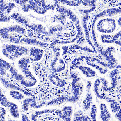 GRIA2 Recombinant Rabbit mAb (S-3446-123)