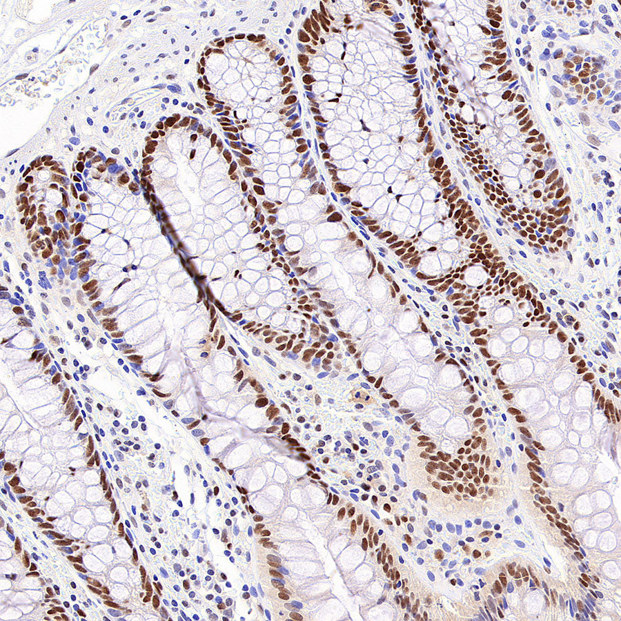 Chk2 Recombinant Rabbit mAb