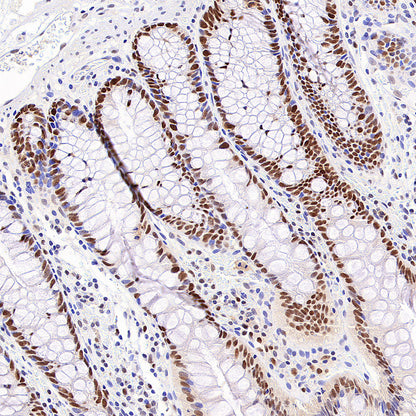 Chk2 Recombinant Rabbit mAb