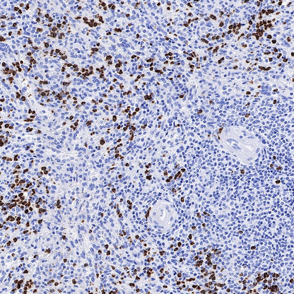 CD66b Recombinant Rabbit mAb (S-766-55)