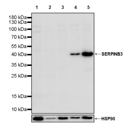 SERPINB3 Recombinant Rabbit mAb (S-4587)