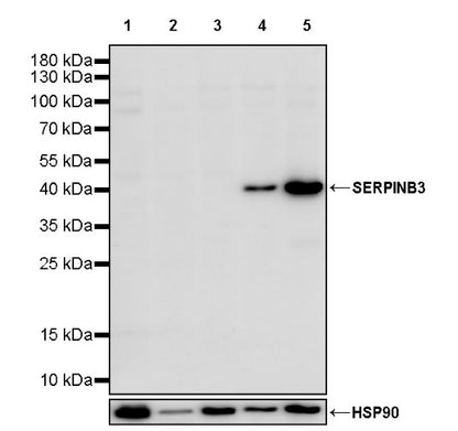 SERPINB3 Recombinant Rabbit mAb (S-4587)