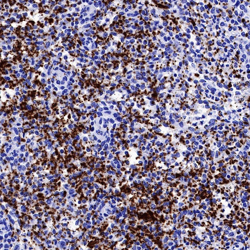 Factor XIIIa Recombinant Rabbit mAb (SDT-644-7)