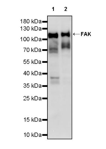 FAK Recombinant Rabbit mAb (S-1180-10)