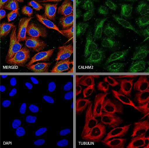 CALHM2 Recombinant Rabbit mAb (S-2671-146)