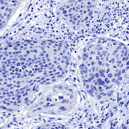Hepatocyte Specific Antigen Recombinant Mouse mAb (SDT-4389)
