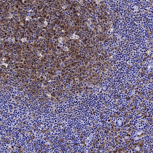 PKC delta Recombinant Rabbit mAb (S-2611-39)