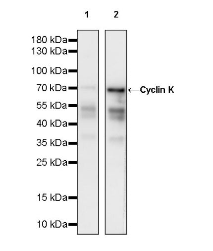 Cyclin K Recombinant Rabbit mAb (S-1586-18)