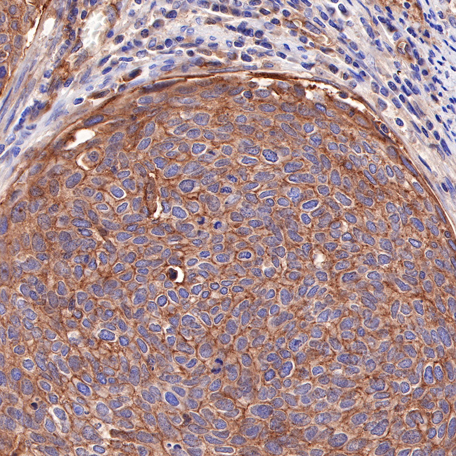 CD155/PVR Recombinant Rabbit mAb (SDT-289-68)