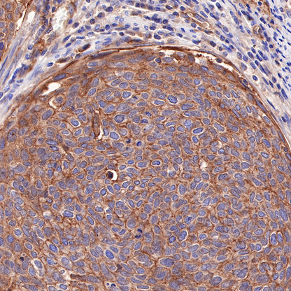 CD155/PVR Recombinant Rabbit mAb (SDT-289-68)