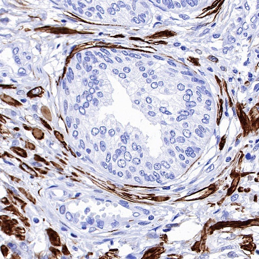 S-RMab® Desmin Recombinant Rabbit mAb (SDT-109-114)