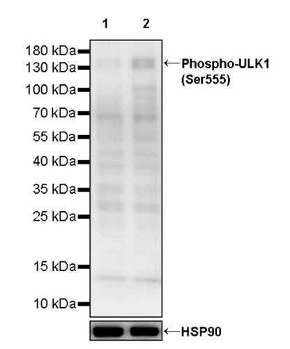 Phospho-ULK1 (Ser555) Recombinant Rabbit mAb (S-3440)
