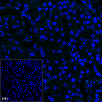 Claudin18.2 Recombinant Rabbit mAb,PBS Only (SDT-102-24)