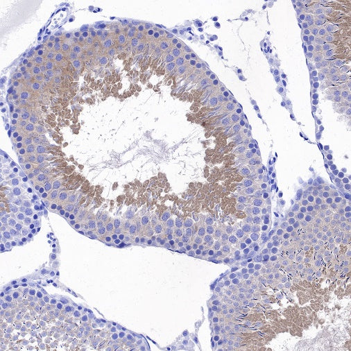 LKB1 Recombinant Rabbit mAb (S-1264-31)