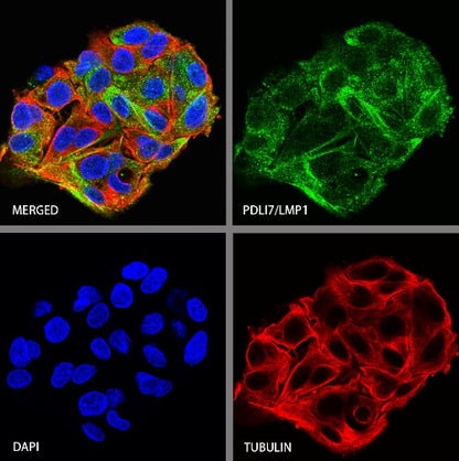 PDLI7/LMP1 Recombinant Rabbit mAb (S-2150-68)