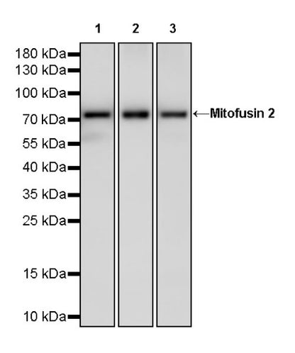 Mitofusin 2 Recombinant Rabbit mAb (S-1783-49)