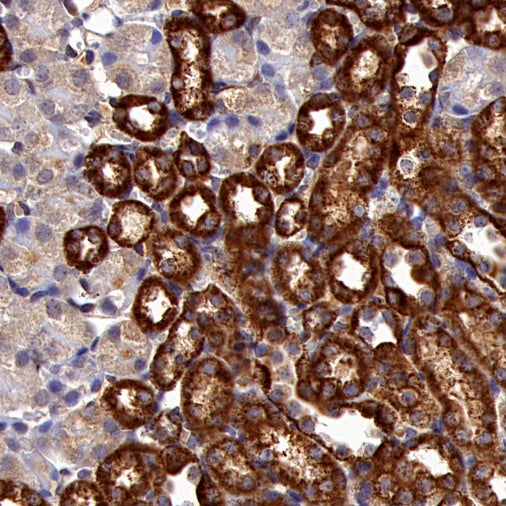 Hexokinase II Rabbit Polyclonal Antibody